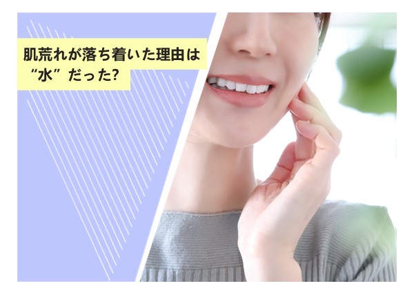 肌荒れが落ち着いた理由は“水”だった？